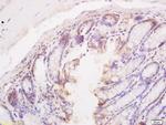 Bim/BCL2L11 Antibody in Immunohistochemistry (Paraffin) (IHC (P))