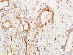 MUC1 Antibody in Immunohistochemistry (Paraffin) (IHC (P))