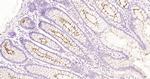 MUC1 Antibody in Immunohistochemistry (Paraffin) (IHC (P))