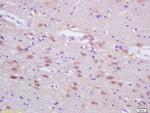 FASN/Fatty Acid Synthase Antibody in Immunohistochemistry (Paraffin) (IHC (P))