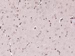C1orf103 Antibody in Immunohistochemistry (Paraffin) (IHC (P))