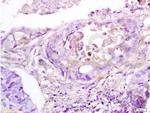 RAP1A Antibody in Immunohistochemistry (Paraffin) (IHC (P))