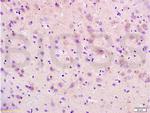 RAP1A Antibody in Immunohistochemistry (Paraffin) (IHC (P))