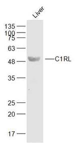 C1RL Antibody in Western Blot (WB)