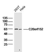 C20orf152 Antibody in Western Blot (WB)