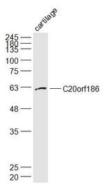 C20orf186 Antibody in Western Blot (WB)