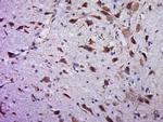 C20orf94 Antibody in Immunohistochemistry (Paraffin) (IHC (P))