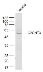 C2GNT3 Antibody in Western Blot (WB)