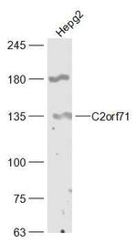C2orf71 Antibody in Western Blot (WB)