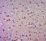 C3orf25 Antibody in Immunohistochemistry (Paraffin) (IHC (P))