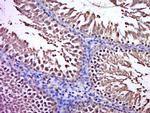 C3orf32 Antibody in Immunohistochemistry (Paraffin) (IHC (P))