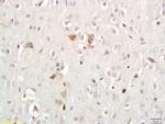 Persephin Antibody in Immunohistochemistry (Paraffin) (IHC (P))