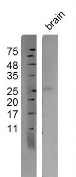 Persephin Antibody in Western Blot (WB)