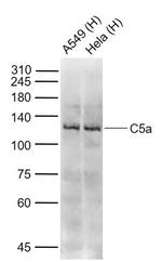 C5 Antibody in Western Blot (WB)