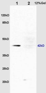Phospho-ERK1 (Thr183, Tyr185) Antibody in Western Blot (WB)