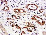 C6orf52 Antibody in Immunohistochemistry (Paraffin) (IHC (P))