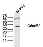 C6orf62 Antibody in Western Blot (WB)