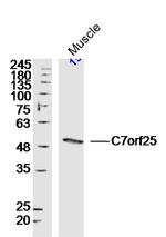 C7orf25 Antibody in Western Blot (WB)