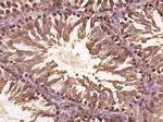 C8orf42 Antibody in Immunohistochemistry (Paraffin) (IHC (P))