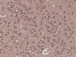 c8orf84 Antibody in Immunohistochemistry (Paraffin) (IHC (P))