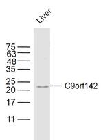 C9orf142 Antibody in Western Blot (WB)