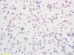 Phospho-LKB1 (Thr363) Antibody in Immunohistochemistry (Paraffin) (IHC (P))