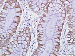 GPCR EX33 Antibody in Immunohistochemistry (Paraffin) (IHC (P))