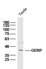 GPS2 Antibody in Western Blot (WB)