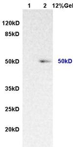 IL-7Ra/CD127 Antibody in Western Blot (WB)