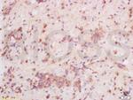 Heparanase Antibody in Immunohistochemistry (Paraffin) (IHC (P))