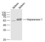 Heparanase Antibody in Western Blot (WB)