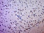 HCCS Antibody in Immunohistochemistry (Paraffin) (IHC (P))