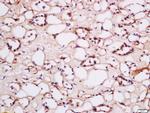 HCP1 Antibody in Immunohistochemistry (Paraffin) (IHC (P))