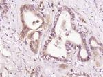 HDPTP Antibody in Immunohistochemistry (Paraffin) (IHC (P))