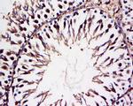 HECT E3 ubiquitin ligase Antibody in Immunohistochemistry (Paraffin) (IHC (P))