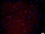 HEG1 Antibody in Immunohistochemistry (Paraffin) (IHC (P))