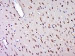 HELZ Antibody in Immunohistochemistry (Paraffin) (IHC (P))