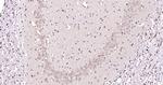 HERPUD1 Antibody in Immunohistochemistry (Paraffin) (IHC (P))