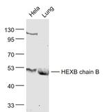 HEXB chain B Antibody in Western Blot (WB)