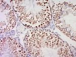 HEXO Antibody in Immunohistochemistry (Paraffin) (IHC (P))