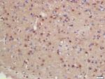 hHR23b Antibody in Immunohistochemistry (Paraffin) (IHC (P))