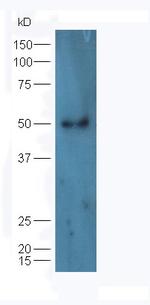 hHR23b Antibody in Western Blot (WB)
