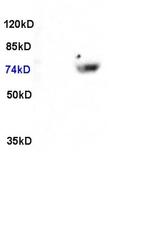 FOXO3A Antibody in Western Blot (WB)