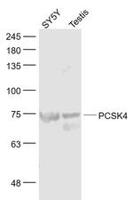 PCSK4 Antibody in Western Blot (WB)