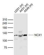 NCX1/SLC8A1 Antibody in Western Blot (WB)