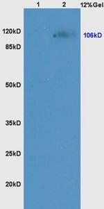 NCX1/SLC8A1 Antibody in Western Blot (WB)