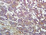 IFIT1B Antibody in Immunohistochemistry (Paraffin) (IHC (P))
