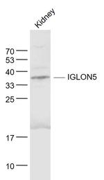 IGLON5 Antibody in Western Blot (WB)