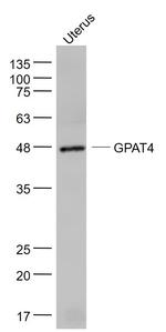 GPAT4 Antibody in Western Blot (WB)