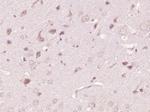 ATP7A Antibody in Immunohistochemistry (Paraffin) (IHC (P))
